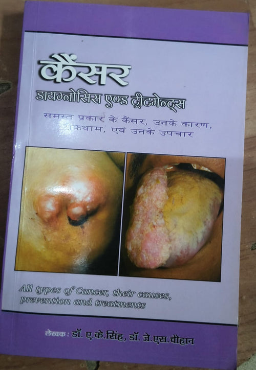 कैंसर डायग्नोसिस एण्ड ट्रीटमेन्ट्स