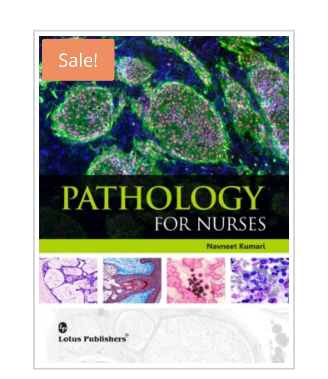 Pathology for Nurses  
Author:  
Navneet Kumari  
Publisher:  
Lotus Publishers